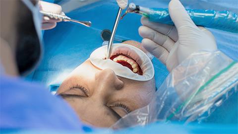 Χειρουργική Στόματος